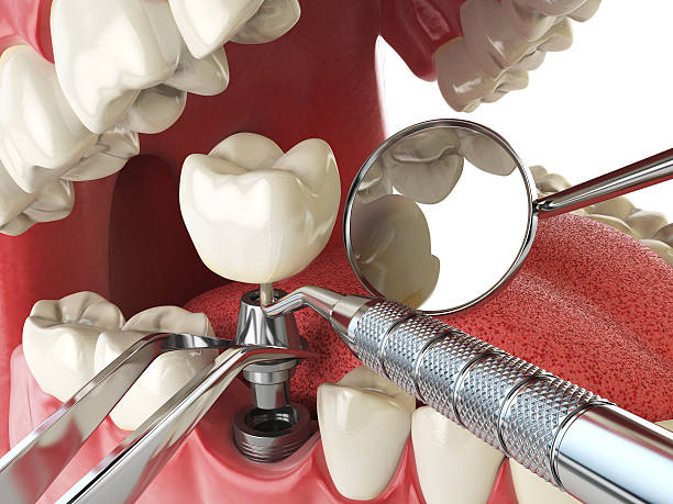 Best Emergency Dental Care for Sports Injuries in Gordon, GA